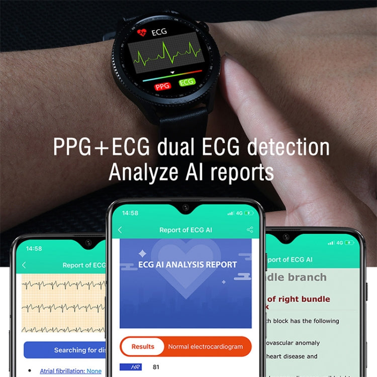 Smart Watch – ECG, Blood Oxygen, Body Temperature, IP68 Waterproof, NORTH EDGE E102