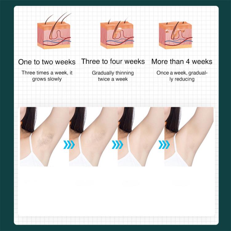 FY-B501 Laser Hair Removal Device Home Electric IPL Intense Pulse Hair Remover - It uses a repetition frequency of