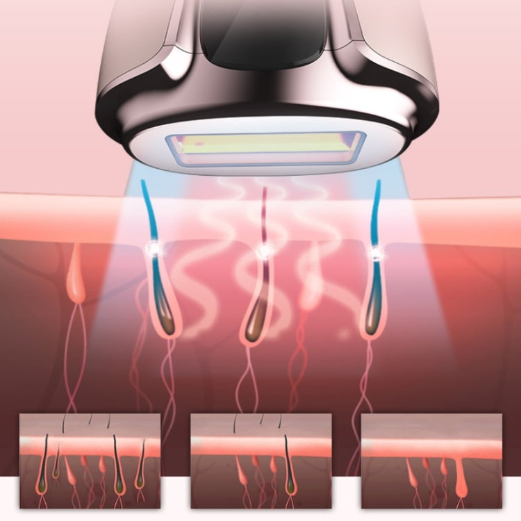 Ladies Laser Hair Removal Device Home IPL Photon Electric Skin Rejuvenation Device - Wavelength of epilator: 550nm-1200nm